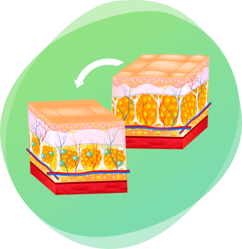 Nano Slim hatása a bőrre